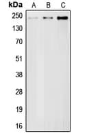 Polyclonal Rabbit anti-Human BRCA1 Antibody (Internal, IHC, WB)