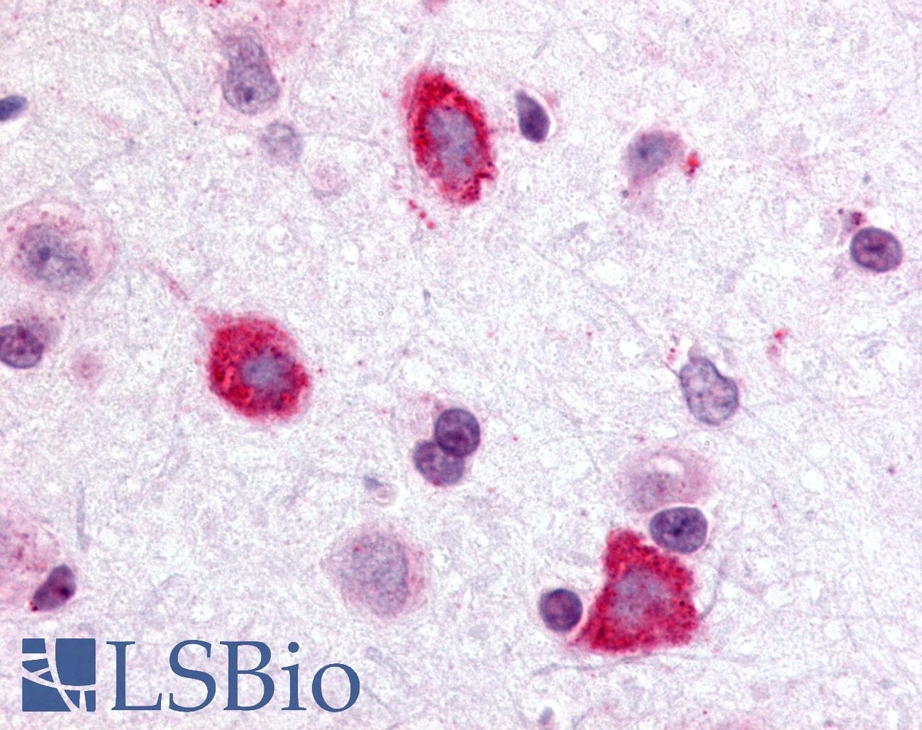 PathPlus™ GALR3 / Galanin Receptor 3 Antibody (Cytoplasmic Domain)