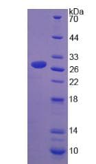 Human LCP1 / L-Plastin Protein (Recombinant His)