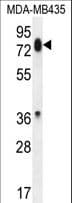 PCDHB13 Antibody (aa273-300)