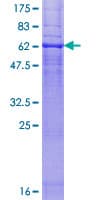 Human CNR2 / CB2 Protein (Recombinant GST)
