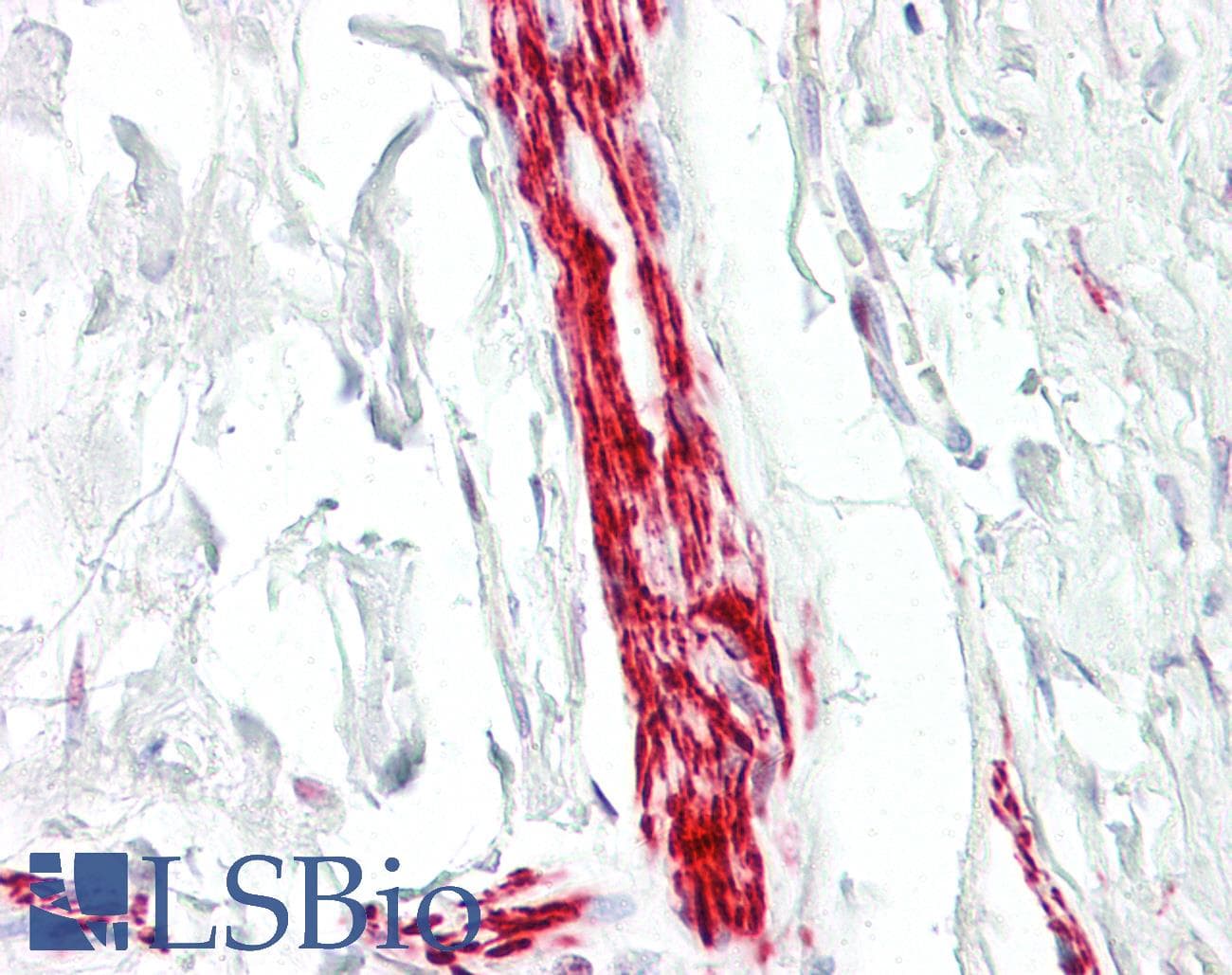 IHC-plus™ MEF2A / MEF2 Antibody (aa374-423)
