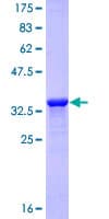 Human LAMA3 / Laminin Alpha 3 Protein (Recombinant GST, N-terminus)