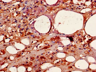 CSNK2B / Phosvitin Antibody