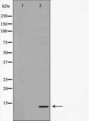 CALCA Antibody