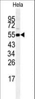 Polyclonal Rabbit anti-Human RIPK3 / RIP3 Antibody (aa61-91, IHC, WB)