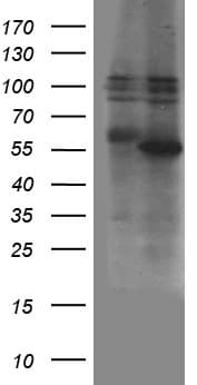 ZBTB32 / TZFP Antibody (aa1-300, clone OTI2H8)