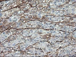 Adiponectin Antibody (aa19-244, clone OTI1H1, Carrier-free)