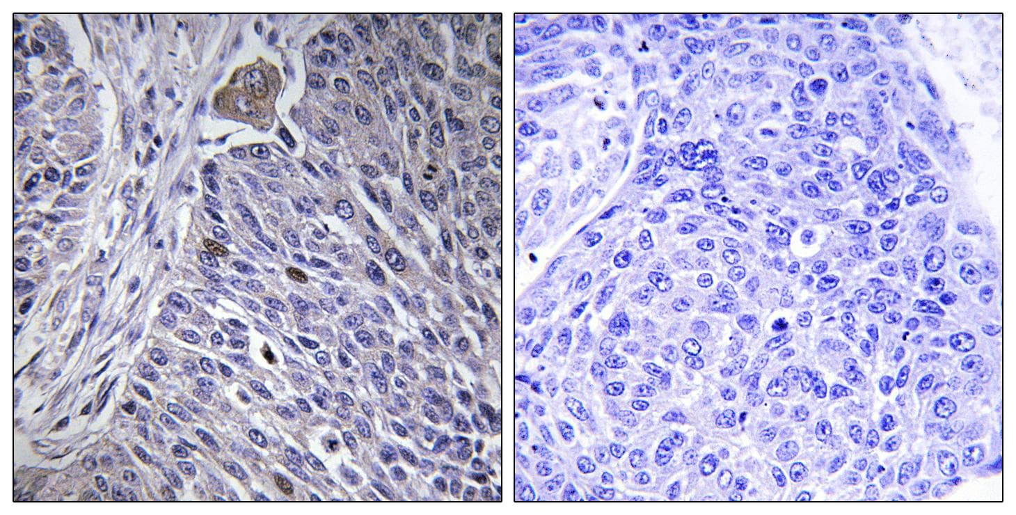 HNRNPDL / hnRNP D Antibody