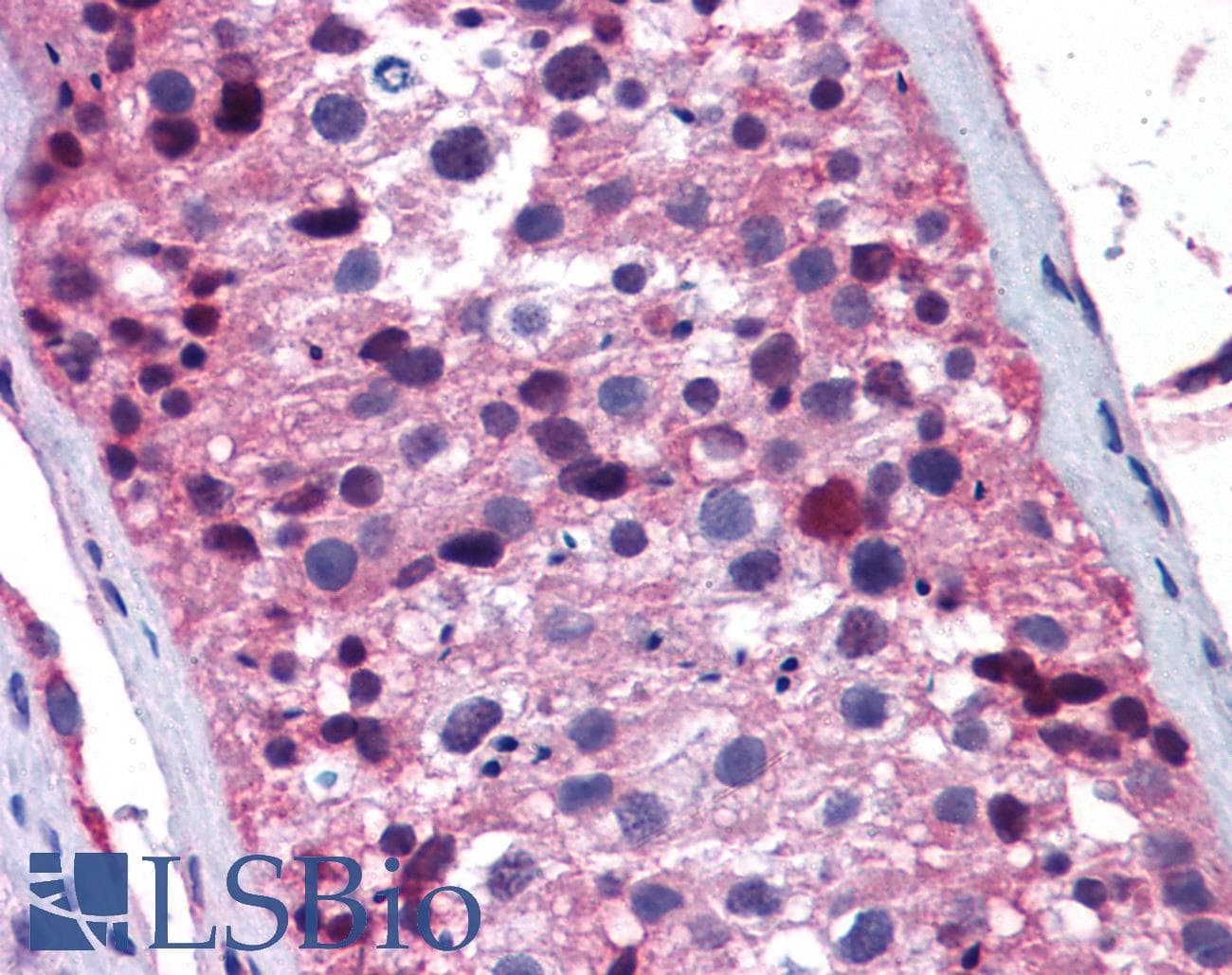 FOXO1 / FKHR Antibody (aa373-422)