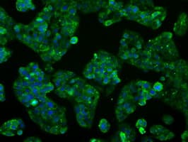 CYP2E1 Antibody (clone OTI5B9)