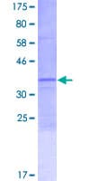 Human KRTAP5-7 Protein (Recombinant GST)