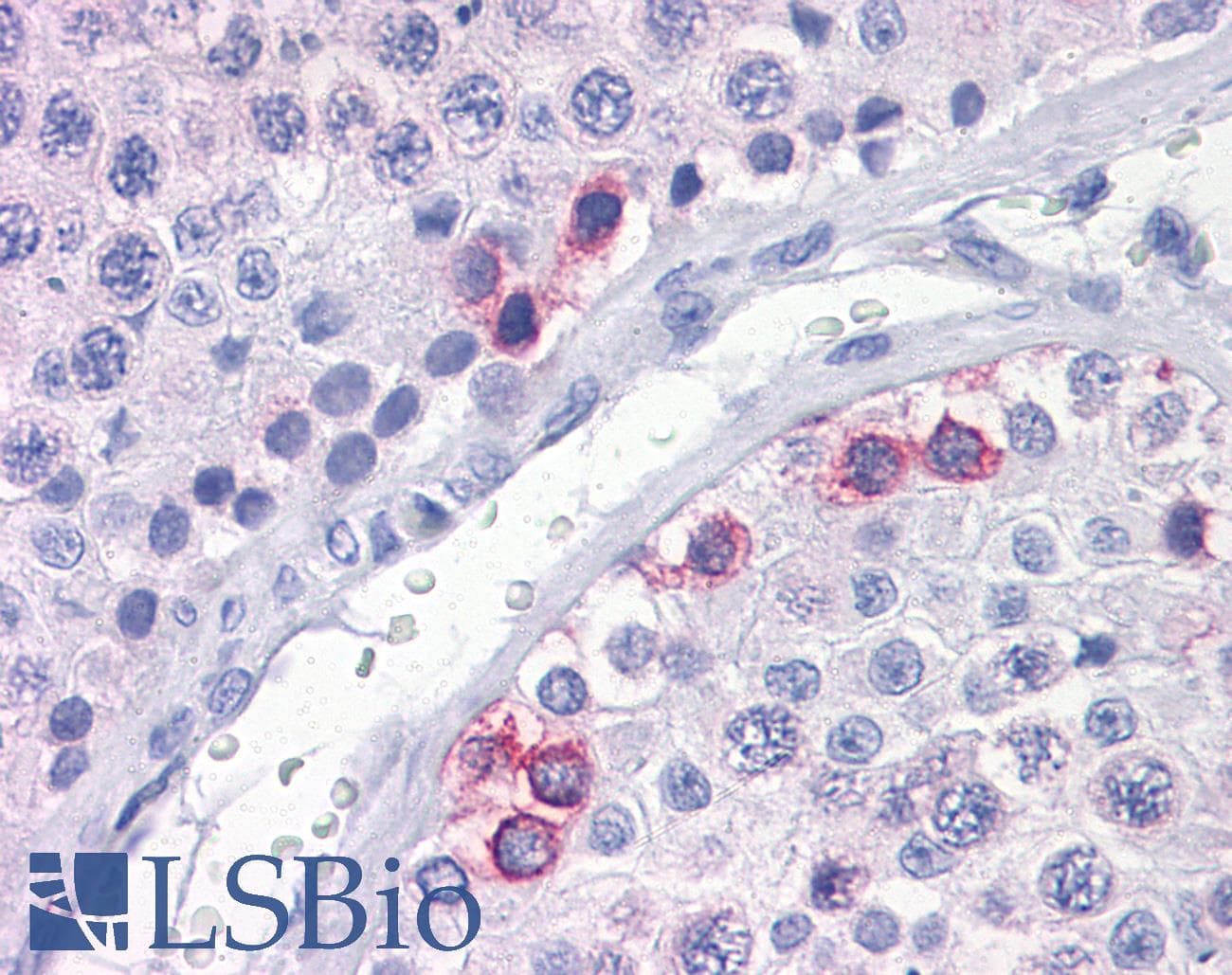 IHC-plus™ DAZ1 / DAZ Antibody (clone 3G10)