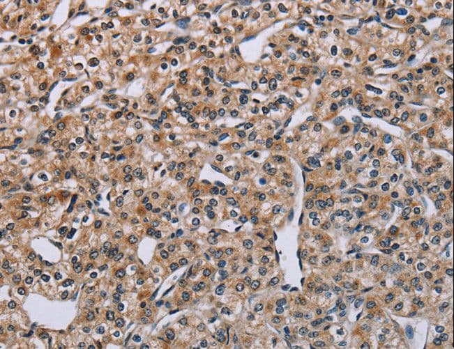PNPT1 Antibody