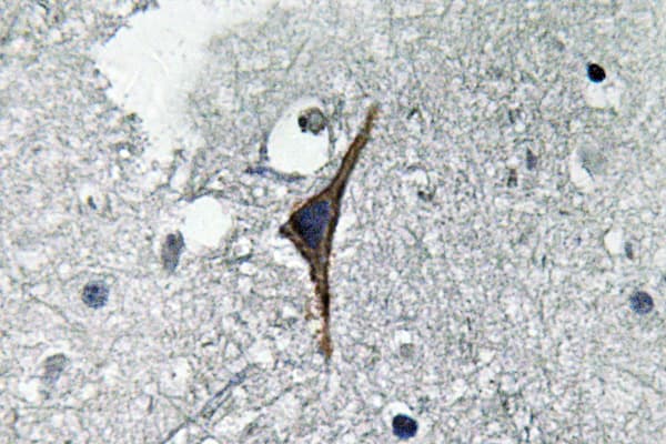 Polyclonal Rabbit anti-Human NOS3 / eNOS Antibody (Ser1170, IHC, IF, WB)