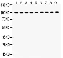 NR3C1/Glucocorticoid Receptor Antibody (aa20-199)