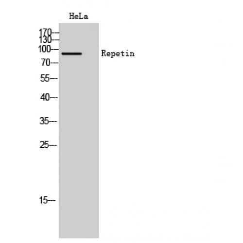 Polyclonal Rabbit anti-Human RPTN / Repetin Antibody (620-700 aa, C-terminal, WB)