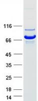 Human NPLOC4 Protein (Recombinant Myc-DDK (Flag))