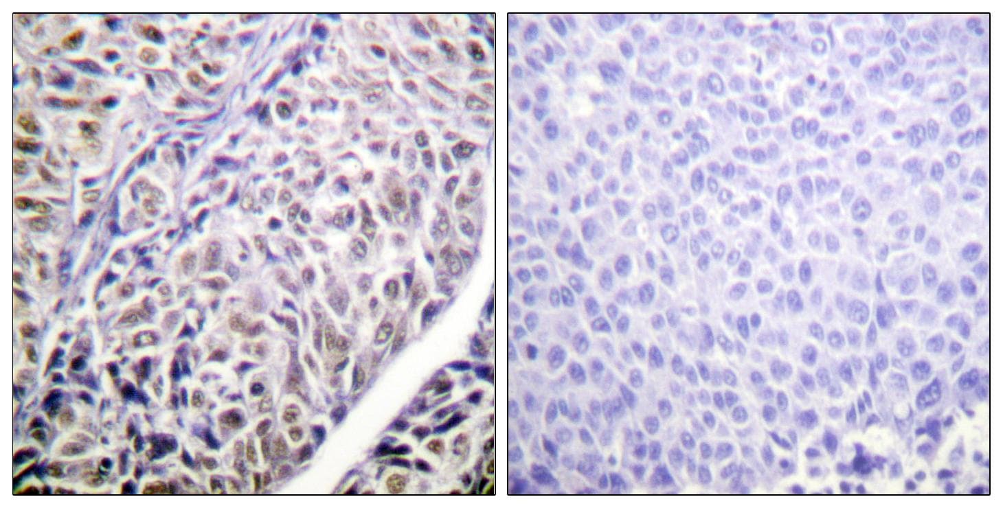AURKB / Aurora-B Antibody (p12)
