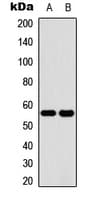 CYP2C19 Antibody (Internal)