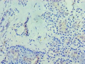 RD / PHYH Antibody (aa1-338)