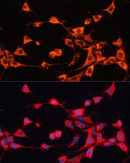 Polyclonal Rabbit anti-Human ABCB10 Antibody (IF)