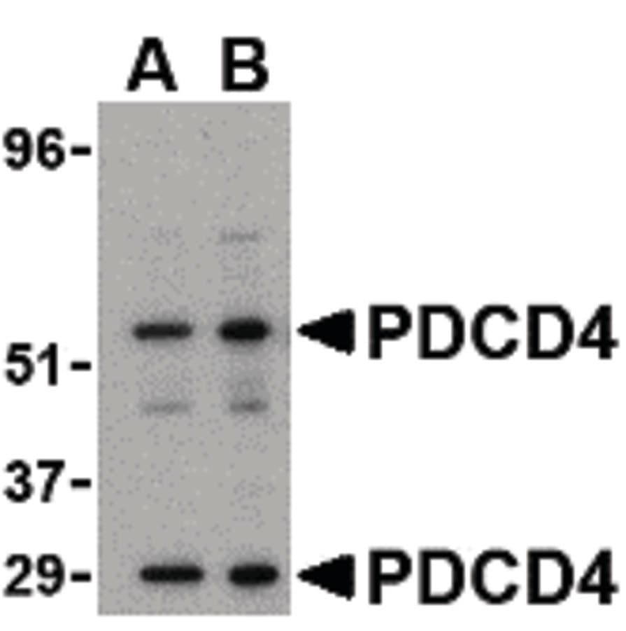PathPlus™ Polyclonal Rabbit anti-Human PDCD4 Antibody (IHC, WB)