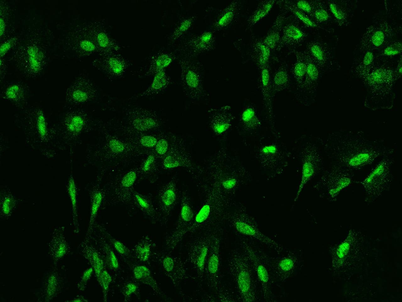 DDX46 Antibody