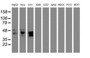 MEIS3 Antibody (aa1-261, clone OTI1B2)