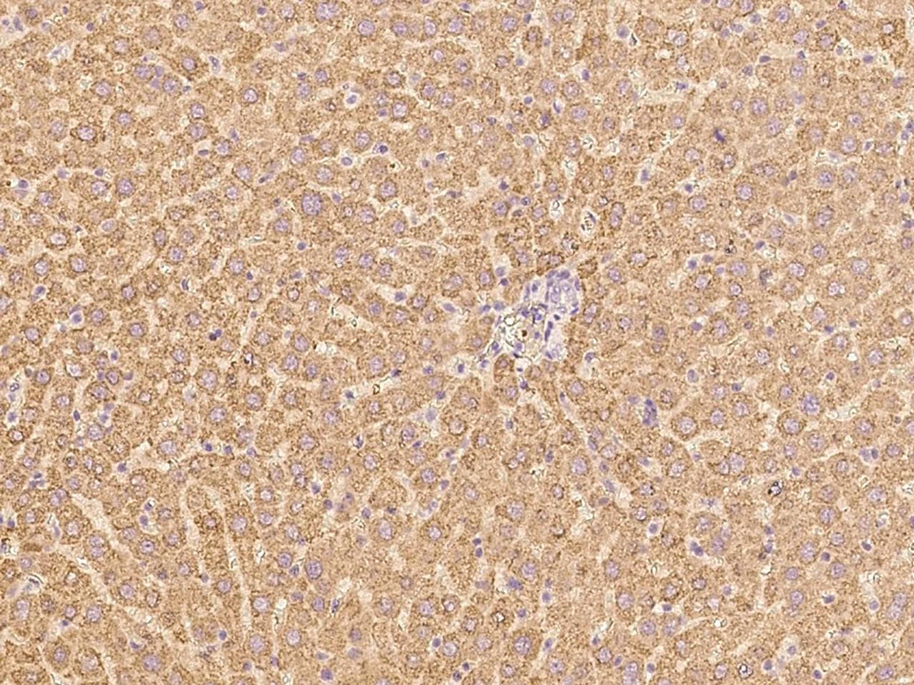 HGF / Hepatocyte Growth Factor Antibody (Preservative Free)