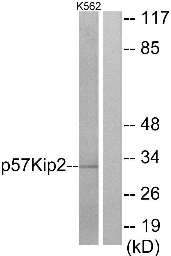 CDKN1C / p57 Kip2 Antibody (p310)