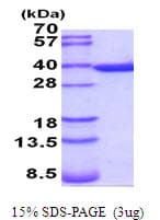 Mouse ANXA5 / Annexin V Protein (Recombinant His)
