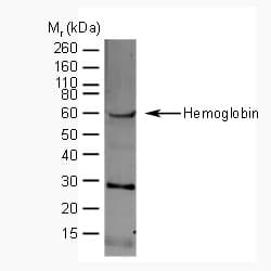 Hemoglobin Antibody