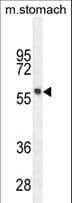 FEZF1 / FEZ Antibody (aa67-96)