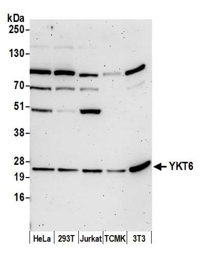 YKT6 Antibody (aa145-195)