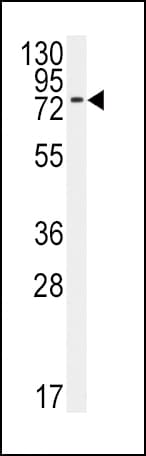 ALK3 / BMPR1A Antibody (aa21-51)