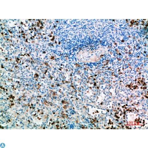 Polyclonal Rabbit anti-Human IL31 Antibody (WB)
