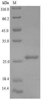 Human RPLP1 Protein (Recombinant 6His-SUMO, N-terminus)