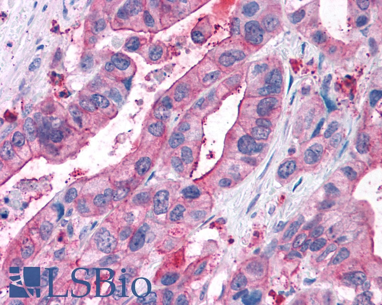 PathPlus™ NPY5R Antibody (Cytoplasmic Domain)