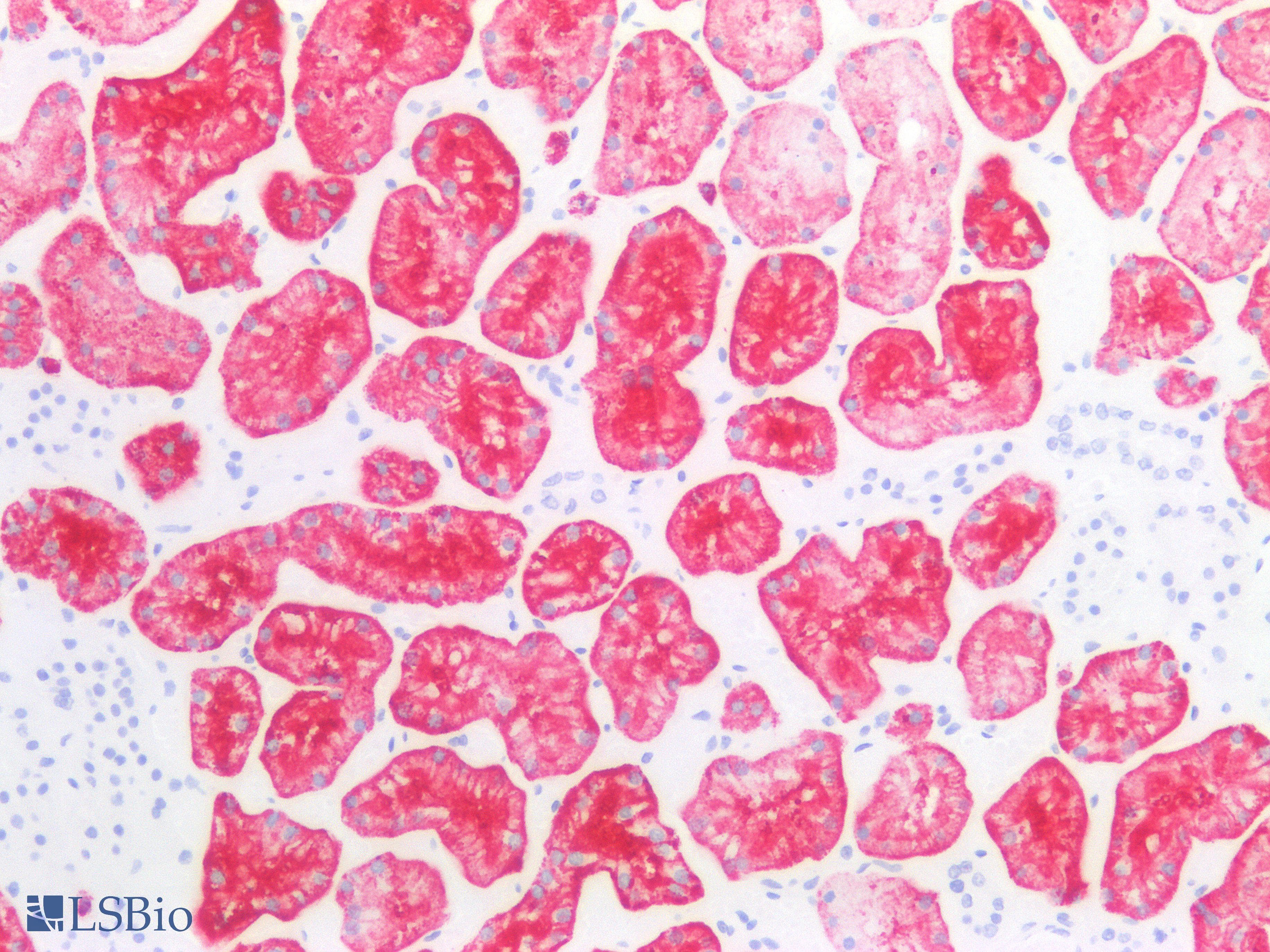 PathPlus™ FUT4 / CD15 Antibody (clone MMA)