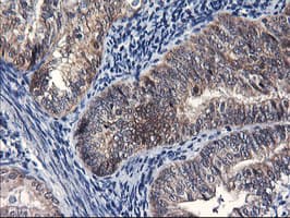 FBXO21 Antibody (clone OTI1E1)