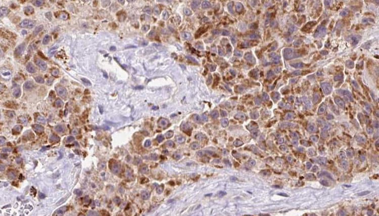 Osteocalcin Antibody