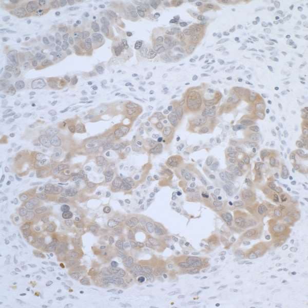 CBS Antibody (aa1-50)