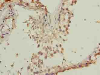 Polyclonal Rabbit anti-Human TMEM140 Antibody (IHC)