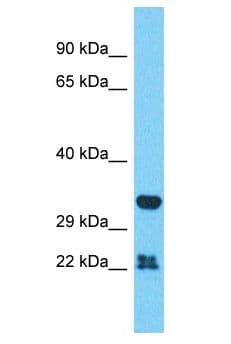 Polyclonal Rabbit anti-Human OR51A2 Antibody (aa65-114, WB)