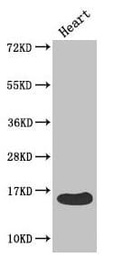 Polyclonal Rabbit anti-Human FABP3 / H-FABP Antibody (IHC, WB)