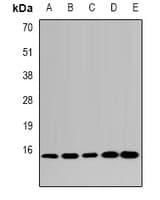 Polyclonal Rabbit anti-Human LSM4 Antibody (IHC, IF, WB)