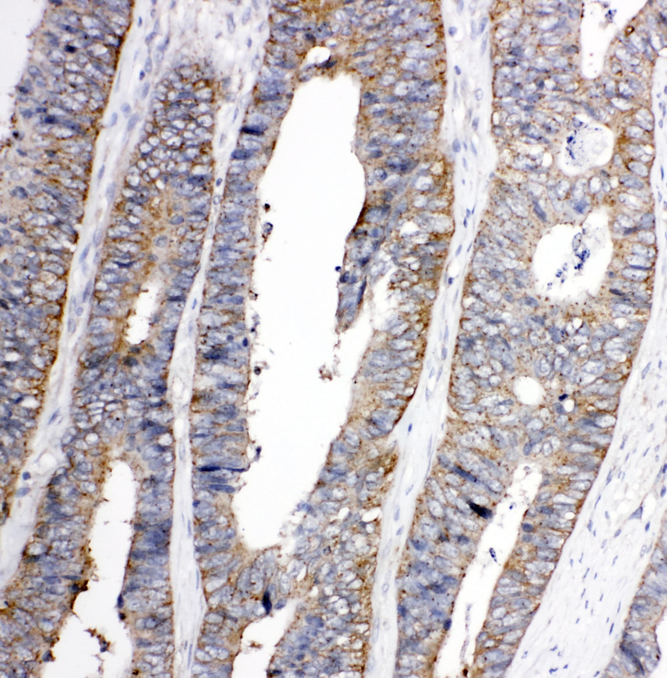Polyclonal Rabbit anti-Human EPHA1 / EPH Receptor A1 Antibody (aa963-976, IHC, WB)