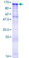 Human STK31 Protein (Recombinant GST)