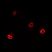 Polyclonal Rabbit anti-Human YTHDC1 Antibody (IF, WB)